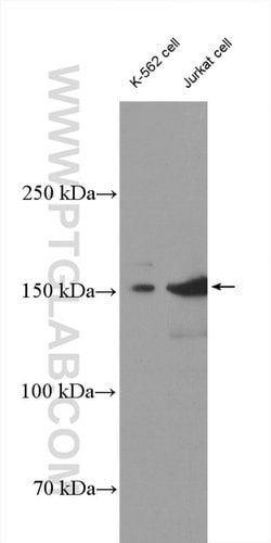 SMARCC1 Rabbit anti-Human, Mouse, Rat, Polyclonal, Proteintech 150 &mu;L;