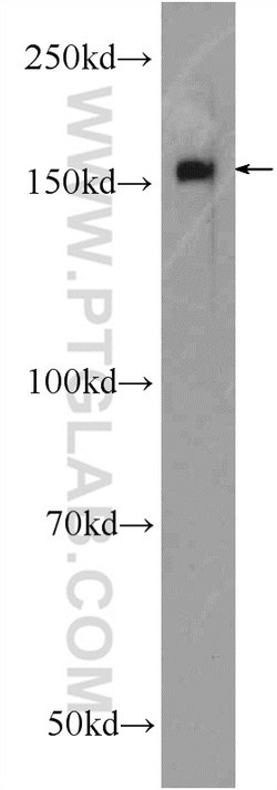 SMARCC1 Rabbit anti-Human, Mouse, Rat, Polyclonal, Proteintech 150 &mu;L;