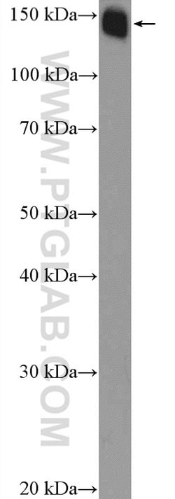 SMARCC1 Rabbit anti-Human, Mouse, Rat, Polyclonal, Proteintech 150 &mu;L;