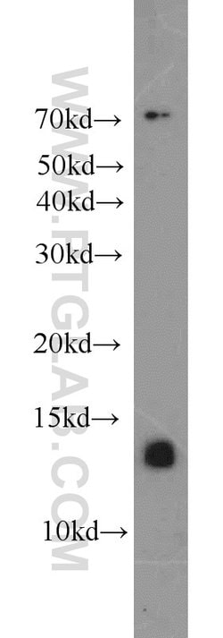 ATP6V1F Rabbit anti-Human, Mouse, Polyclonal, Proteintech 150 &mu;L; Unconjugated:Antibodies,