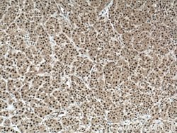 ENOPH1 Rabbit anti-Human, Mouse, Rat, Polyclonal, Proteintech 150 &mu;L | Buy Online | Proteintech Group Inc | Fisher Scientific