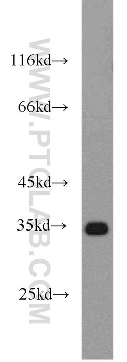 ENOPH1 Rabbit anti-Human, Mouse, Rat, Polyclonal, Proteintech 150 &mu;L | Buy Online | Proteintech Group Inc | Fisher Scientific