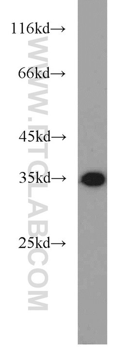 ENOPH1 Rabbit anti-Human, Mouse, Rat, Polyclonal, Proteintech 150 &mu;L | Buy Online | Proteintech Group Inc | Fisher Scientific