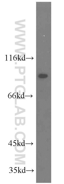 TJAP1 Rabbit anti-Human, Polyclonal, Proteintech 20 &mu;L; Unconjugated:Antibodies,