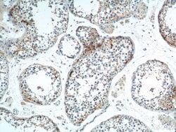 SOHLH1 Rabbit anti-Human, Polyclonal, Proteintech:Antibodies:Primary Antibodies