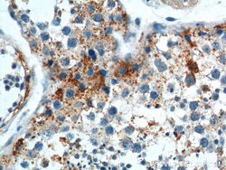 SOHLH1 Rabbit anti-Human, Polyclonal, Proteintech:Antibodies:Primary Antibodies