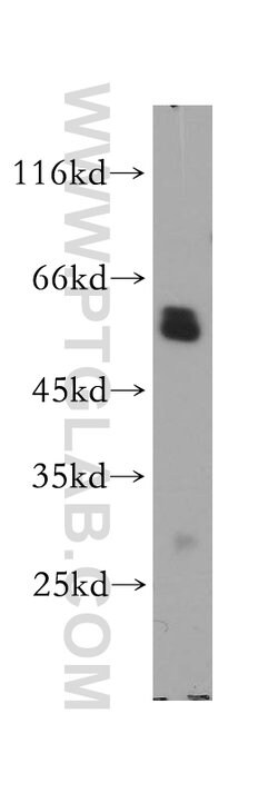 CORO1A Rabbit anti-Human, Mouse, Rat, Polyclonal, Proteintech:Antibodies:Primary