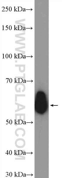 CORO1A Rabbit anti-Human, Mouse, Rat, Polyclonal, Proteintech:Antibodies:Primary