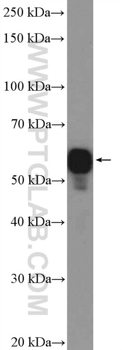CORO1A Rabbit anti-Human, Mouse, Rat, Polyclonal, Proteintech:Antibodies:Primary