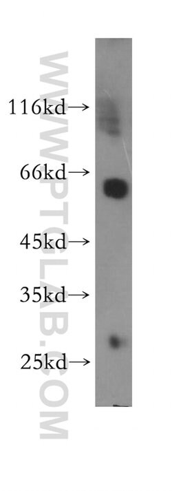 CORO1A Rabbit anti-Human, Mouse, Rat, Polyclonal, Proteintech:Antibodies:Primary