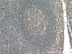 GM-CSF Rabbit anti-Human, Mouse, Polyclonal, Proteintech 150 &mu;L | Buy Online | Proteintech Group Inc | Fisher Scientific