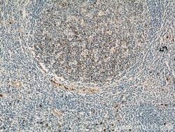 TLR3 Rabbit anti-Human, Mouse, Rat, Polyclonal, Proteintech 150 &mu;L;