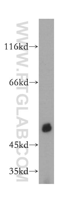 PDE7B Rabbit anti-Human, Mouse, Rat, Polyclonal, Proteintech:Antibodies:Primary