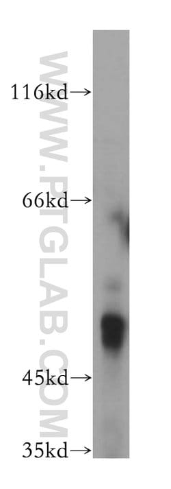 PDE7B Rabbit anti-Human, Mouse, Rat, Polyclonal, Proteintech:Antibodies:Primary