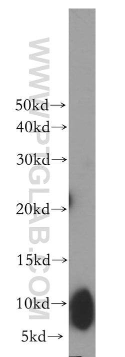 UCRC Rabbit anti-Human, Mouse, Rat, Polyclonal, Proteintech 150 &mu;L;
