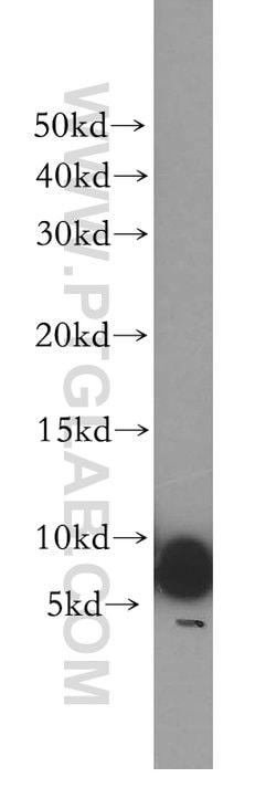 UCRC Rabbit anti-Human, Mouse, Rat, Polyclonal, Proteintech 150 &mu;L;