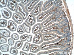 RSPO2 Rabbit anti-Human, Mouse, Rat, Polyclonal, Proteintech:Antibodies:Primary