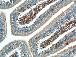 RSPO2 Rabbit anti-Human, Mouse, Rat, Polyclonal, Proteintech:Antibodies:Primary