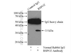RSPO2 Rabbit anti-Human, Mouse, Rat, Polyclonal, Proteintech:Antibodies:Primary
