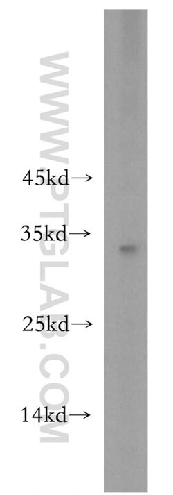 RSPO2 Rabbit anti-Human, Mouse, Rat, Polyclonal, Proteintech:Antibodies:Primary