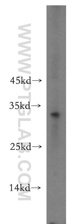 RSPO2 Rabbit anti-Human, Mouse, Rat, Polyclonal, Proteintech:Antibodies:Primary