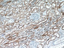 ANT1/2 Rabbit anti-Human, Mouse, Rat, Polyclonal, Proteintech 150 &mu;L;