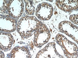 INPP5E Rabbit anti-Human, Mouse, Rat, Polyclonal, Proteintech 150 &mu;L;