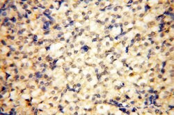 INPP5E Rabbit anti-Human, Mouse, Rat, Polyclonal, Proteintech 150 &mu;L;