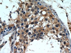 INPP5E Rabbit anti-Human, Mouse, Rat, Polyclonal, Proteintech 150 &mu;L;