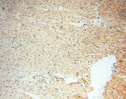 INPP5E Rabbit anti-Human, Mouse, Rat, Polyclonal, Proteintech 150 &mu;L;