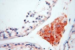 INPP5E Rabbit anti-Human, Mouse, Rat, Polyclonal, Proteintech 150 &mu;L;