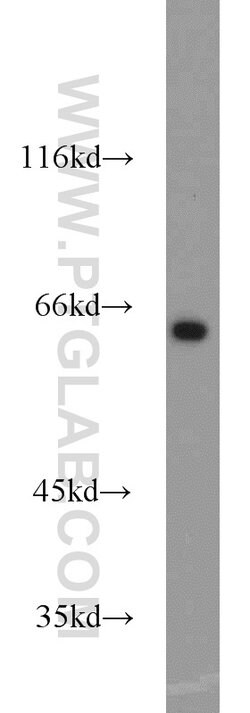INPP5E Rabbit anti-Human, Mouse, Rat, Polyclonal, Proteintech 150 &mu;L;