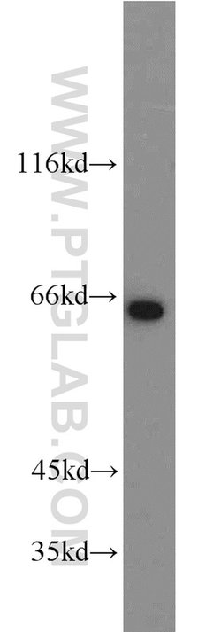 INPP5E Rabbit anti-Human, Mouse, Rat, Polyclonal, Proteintech 150 &mu;L;