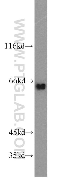 INPP5E Rabbit anti-Human, Mouse, Rat, Polyclonal, Proteintech 150 &mu;L;