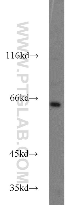 INPP5E Rabbit anti-Human, Mouse, Rat, Polyclonal, Proteintech 150 &mu;L;