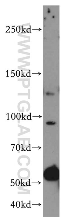 VCPIP1 Rabbit anti-Human, Mouse, Rat, Polyclonal, Proteintech 150 &mu;L | Buy Online | Proteintech Group Inc | Fisher Scientific
