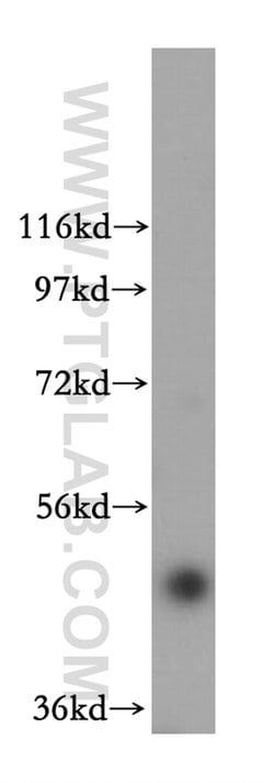 FBXO3 Rabbit anti-Human, Mouse, Rat, Polyclonal, Proteintech 150 &mu;L;