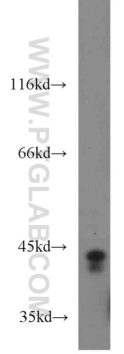 PGK1 Rabbit anti-Human, Mouse, Polyclonal, Proteintech 150 &mu;L; Unconjugated:Antibodies,
