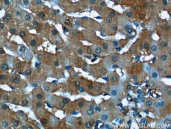 Syntaxin 17 Rabbit anti-Human, Mouse, Rat, Polyclonal, Proteintech:Antibodies:Primary