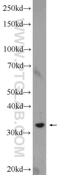 Syntaxin 17 Rabbit anti-Human, Mouse, Rat, Polyclonal, Proteintech:Antibodies:Primary