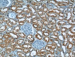 Syntaxin 17 Rabbit anti-Human, Mouse, Rat, Polyclonal, Proteintech:Antibodies:Primary
