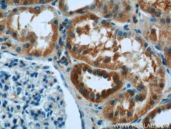 Syntaxin 17 Rabbit anti-Human, Mouse, Rat, Polyclonal, Proteintech:Antibodies:Primary