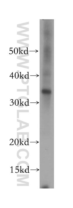 Syntaxin 17 Rabbit anti-Human, Mouse, Rat, Polyclonal, Proteintech:Antibodies:Primary