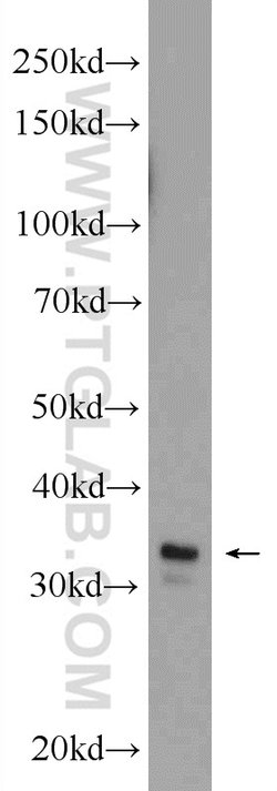 Syntaxin 17 Rabbit anti-Human, Mouse, Rat, Polyclonal, Proteintech:Antibodies:Primary