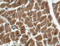 CACNA1G Rabbit anti-Human, Mouse, Rat, Polyclonal, Proteintech 150 &mu;L;