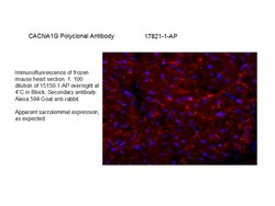 CACNA1G Rabbit anti-Human, Mouse, Rat, Polyclonal, Proteintech 150 &mu;L;