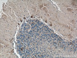 CACNA1G Rabbit anti-Human, Mouse, Rat, Polyclonal, Proteintech 150 &mu;L;