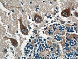 CACNA1G Rabbit anti-Human, Mouse, Rat, Polyclonal, Proteintech 150 &mu;L;