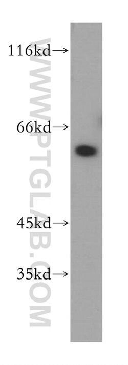 DOK1 Rabbit anti-Human, Polyclonal, Proteintech 150 &mu;L; Unconjugated:Antibodies,