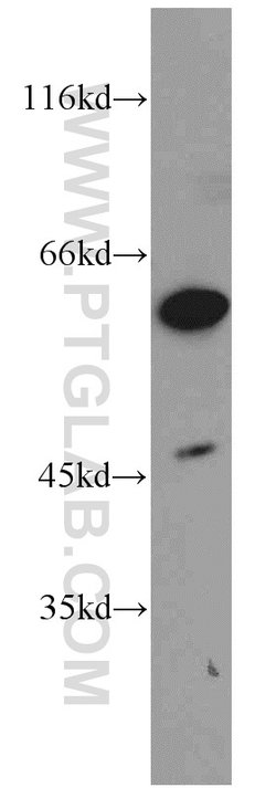 DOK1 Rabbit anti-Human, Polyclonal, Proteintech 150 &mu;L; Unconjugated:Antibodies,